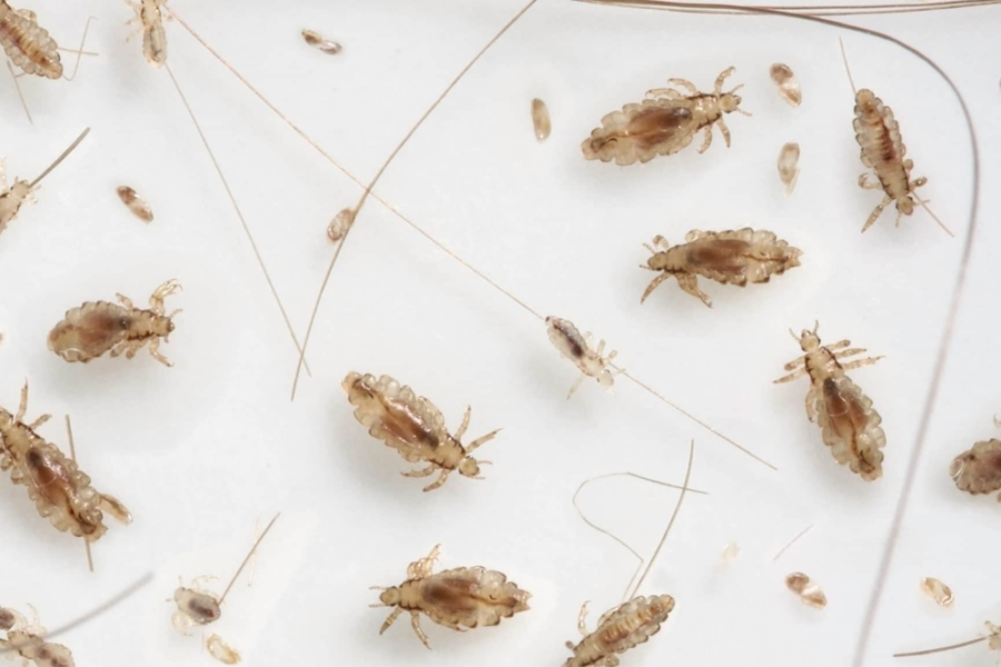 how long is the lice life cycle? – Lice Specialists – Lice Clinic Dubai